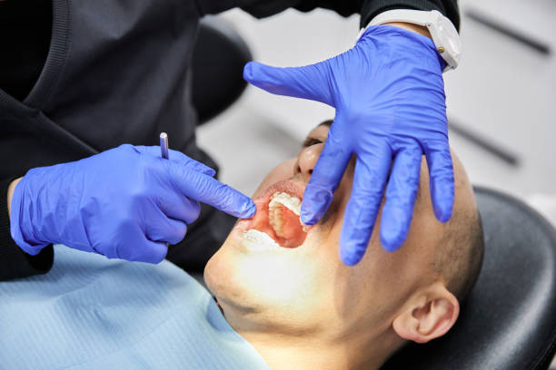 Best Cracked Tooth Emergency Dentist  in Grover, WY