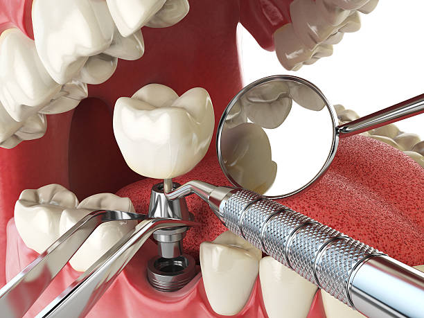 Best Emergency Dental Clinic in WY